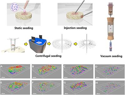 Mesenchymal Stem Cells From Different Sources in Meniscus Repair and Regeneration